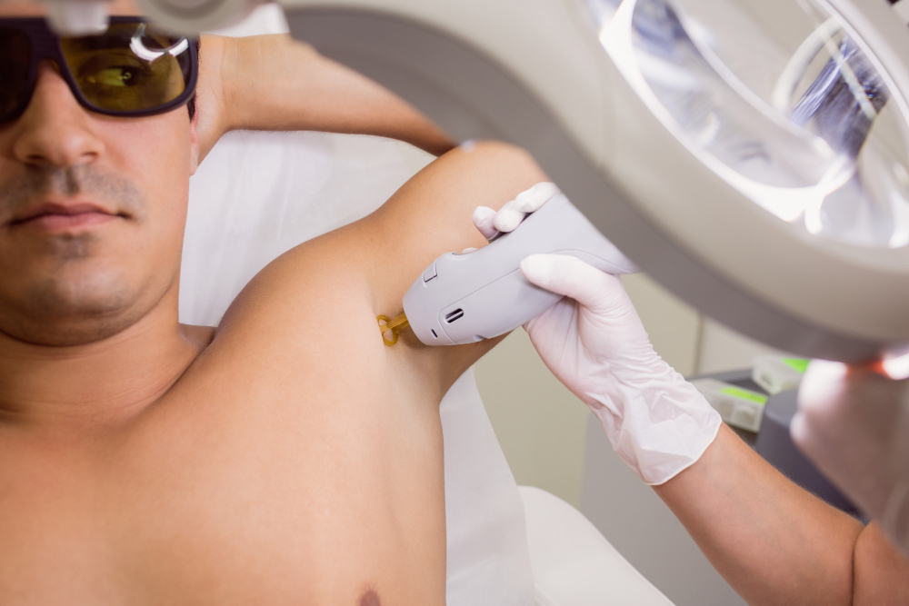 Séance d'épilation laser aisselles à Cannes homme