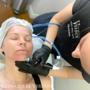 soin hydrafacial pour nettoyer peau acne boutons 