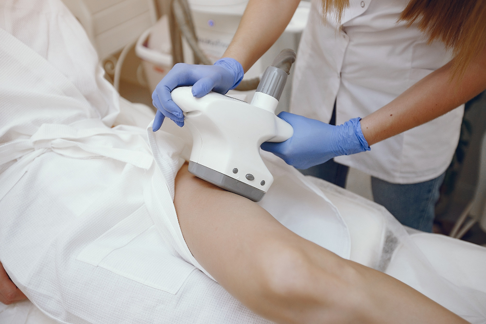 séance de cryolipolyse des cuisses