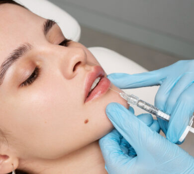 levres injections cannes nice sourire gingivale ride bouche solutions pulpeuses le verdun technique acide hyaluronique levres